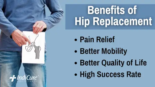 Benefits of Hip Replacement Benefits of Hip Replacement